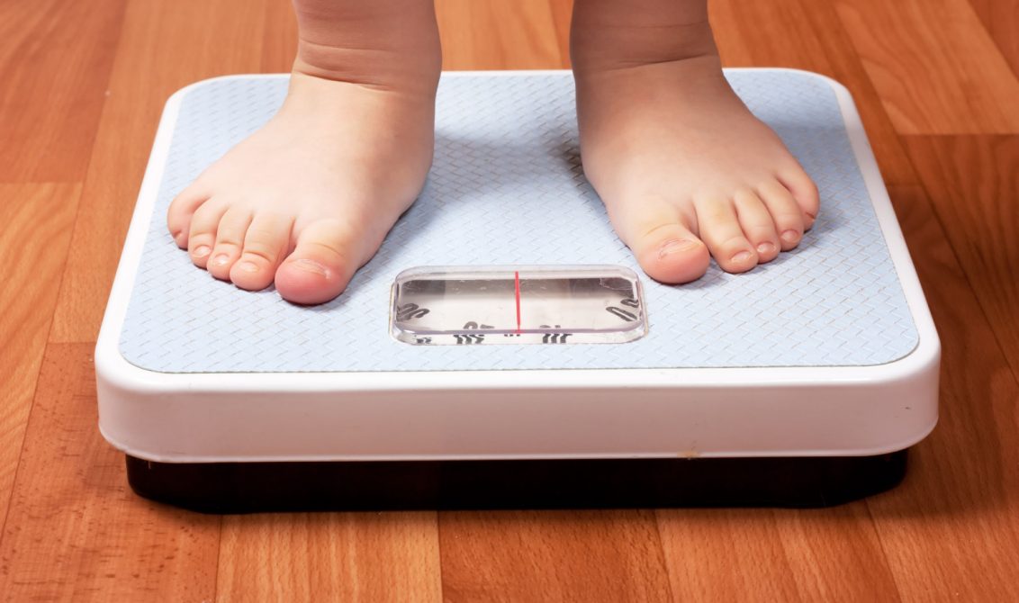 Obesidad infantil, la pandemia del Siglo XXI